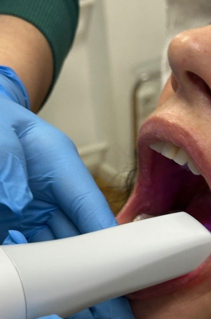 Intraoralscanner